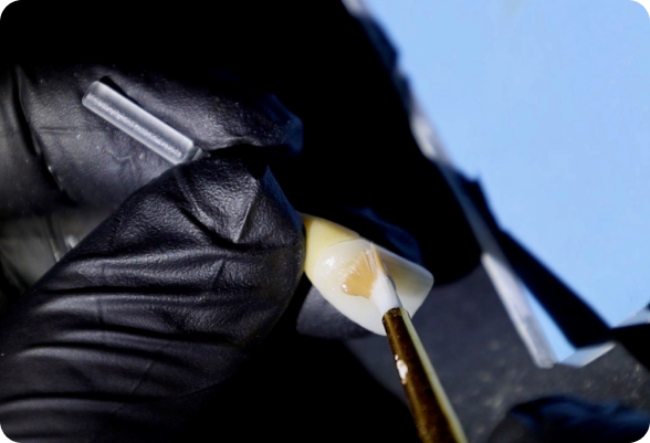 Porcelain Restoration